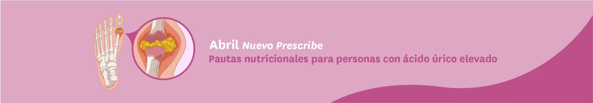 RECOMENDACIONES NUTRICIONALES PARA ÁCIDO ÚRICO 